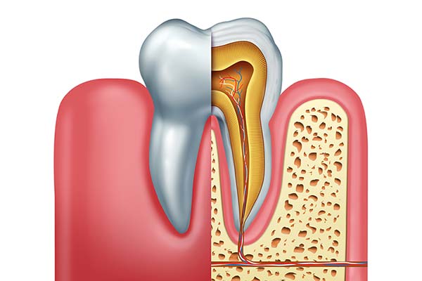 root canal therapy to save an infected tooth